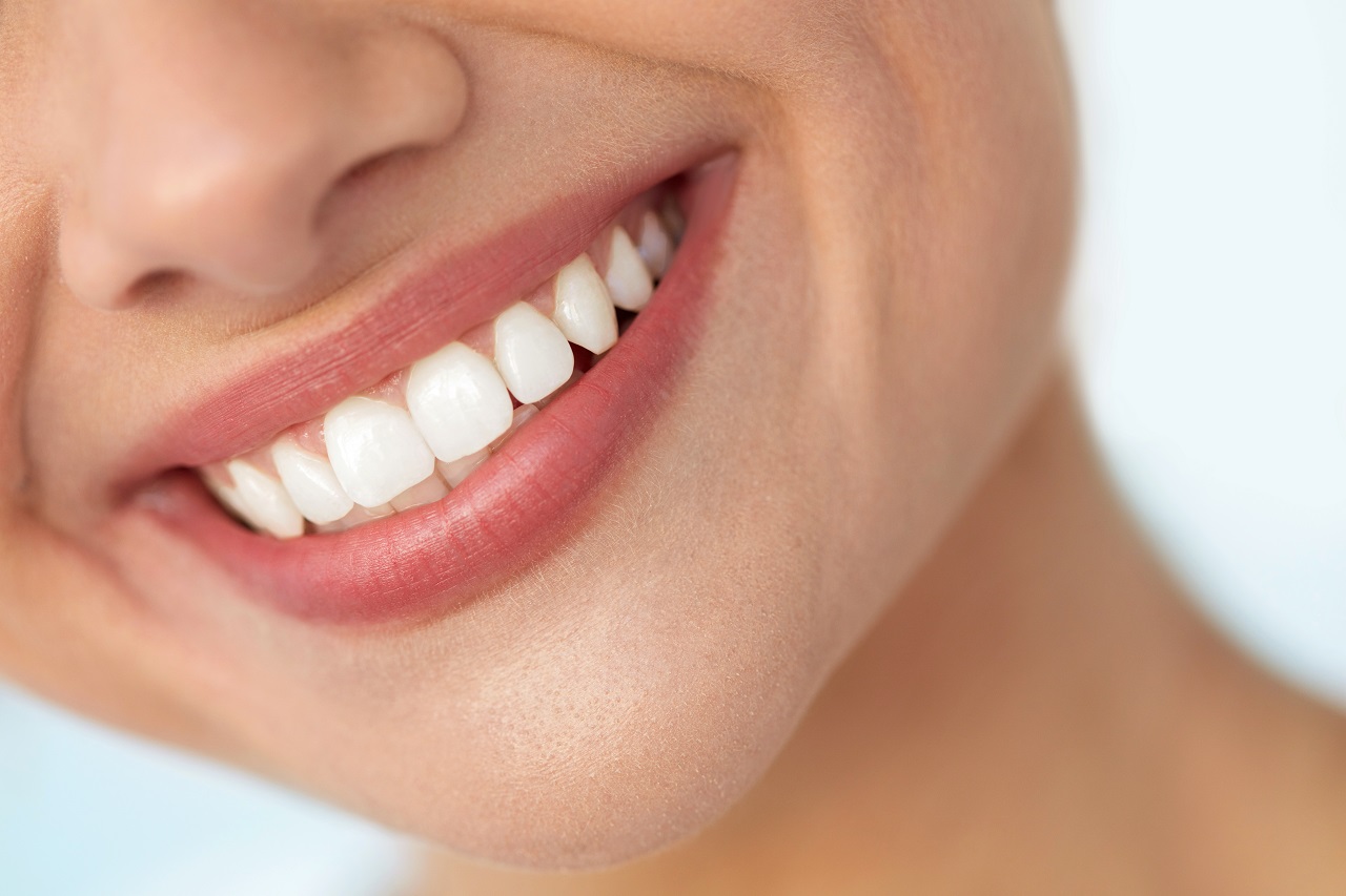 Wybielanie zębów – co warto wiedzieć?
